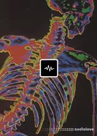 WavSupply Radioactive (Loop Kit) [WAV]